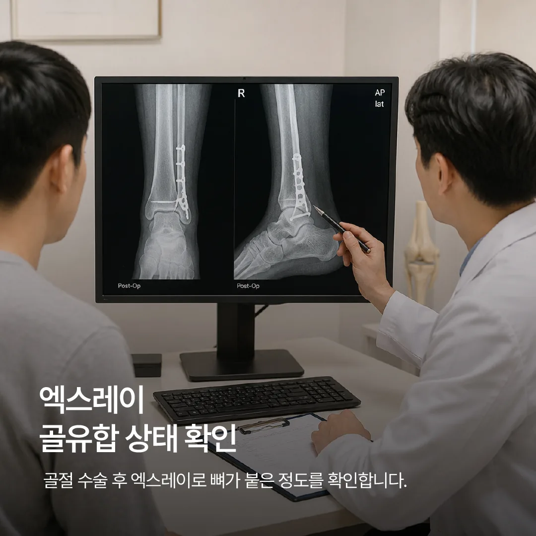 골절 수술 후 엑스레이로 뼈가 붙은 정도를 확인하는 정형외과 외래 진료