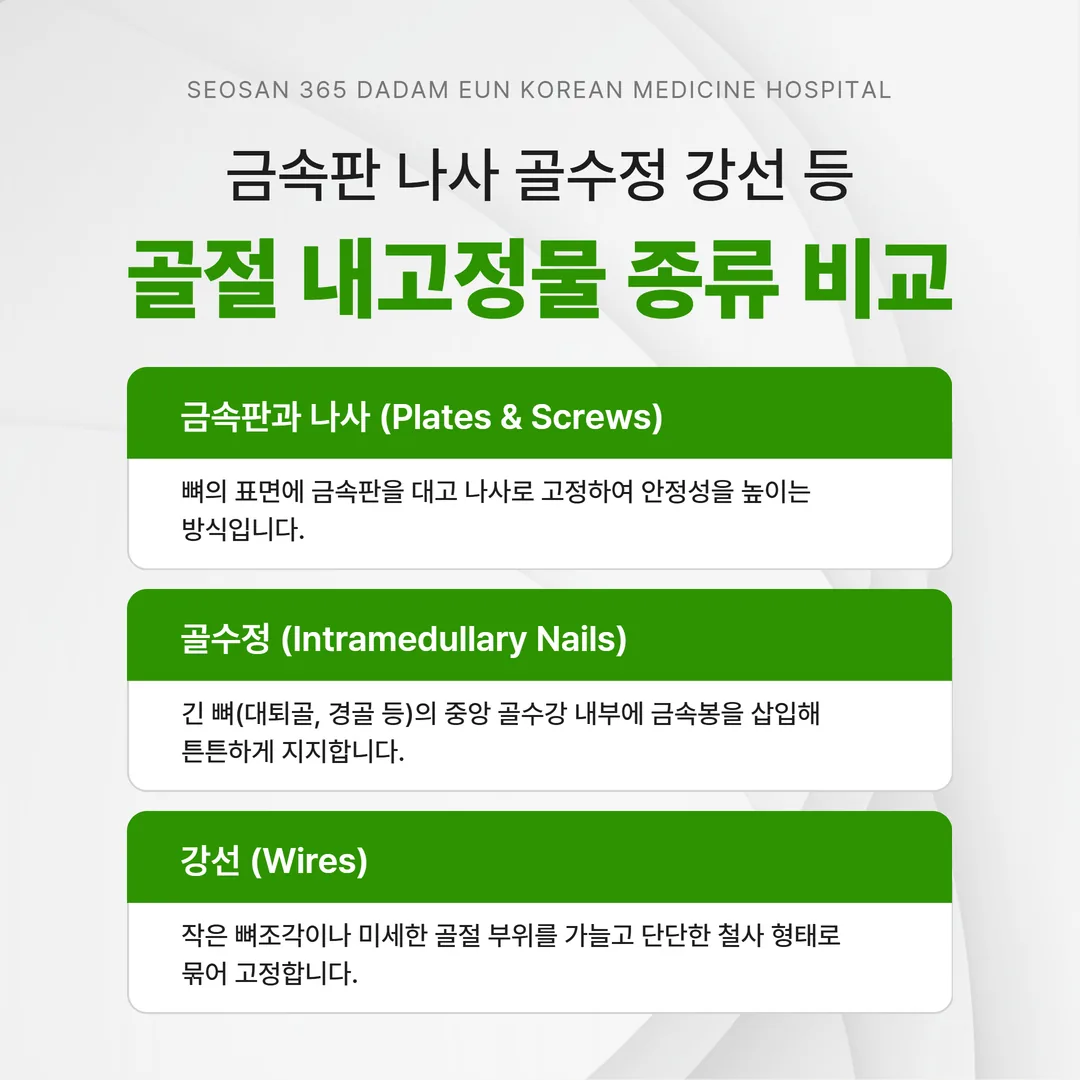 금속판 나사 골수정 강선 등 골절 내고정물 종류 비교 도해