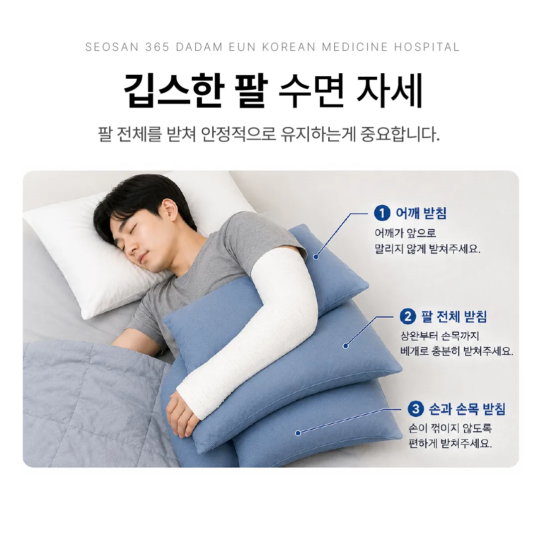 깁스한 팔을 베개로 받쳐 안정시킨 상지 골절 수면 자세