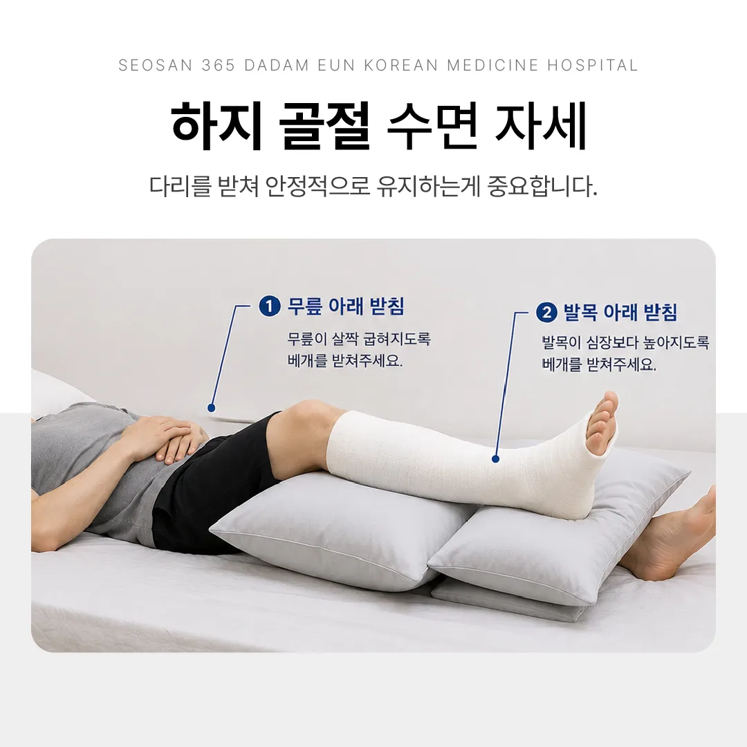 무릎 아래를 받쳐 다리를 안정시킨 하지 골절 수면 자세