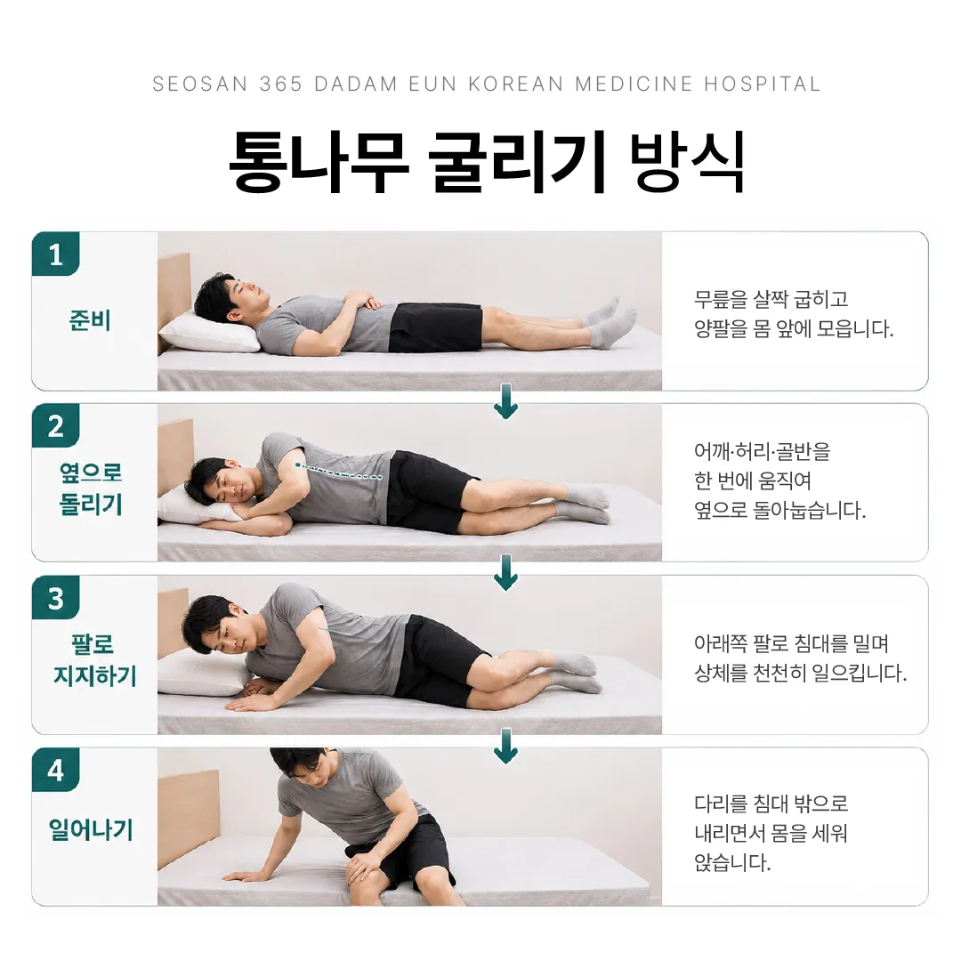 척추압박골절 환자의 통나무 굴리기 방식 눕고 일어나기 단계 도해