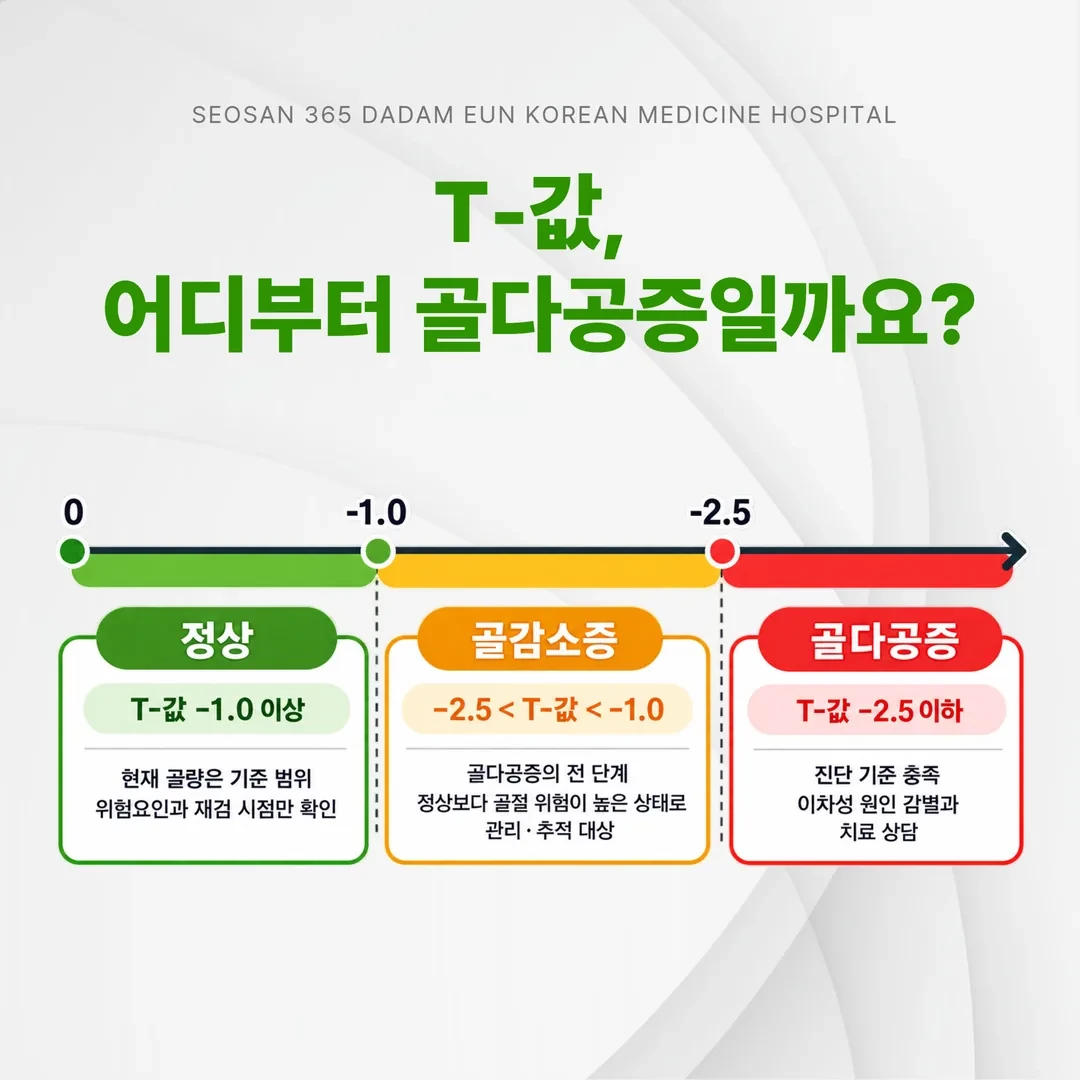 T-값 -1.0과 -2.5를 경계로 정상, 골감소증, 골다공증 구간을 나눈 도해