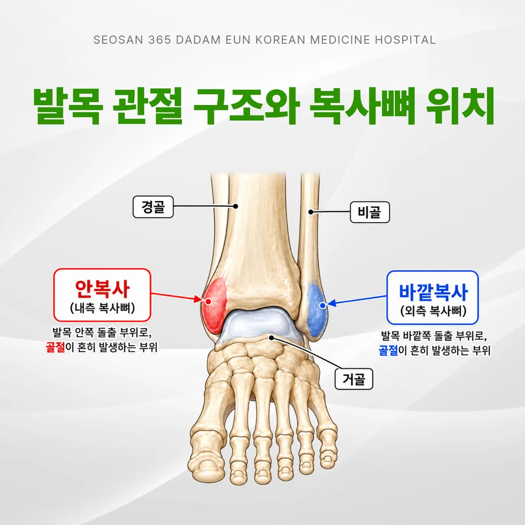 발목 골절이 흔히 생기는 안복사·바깥복사 위치를 표시한 발목 관절 구조 그림
