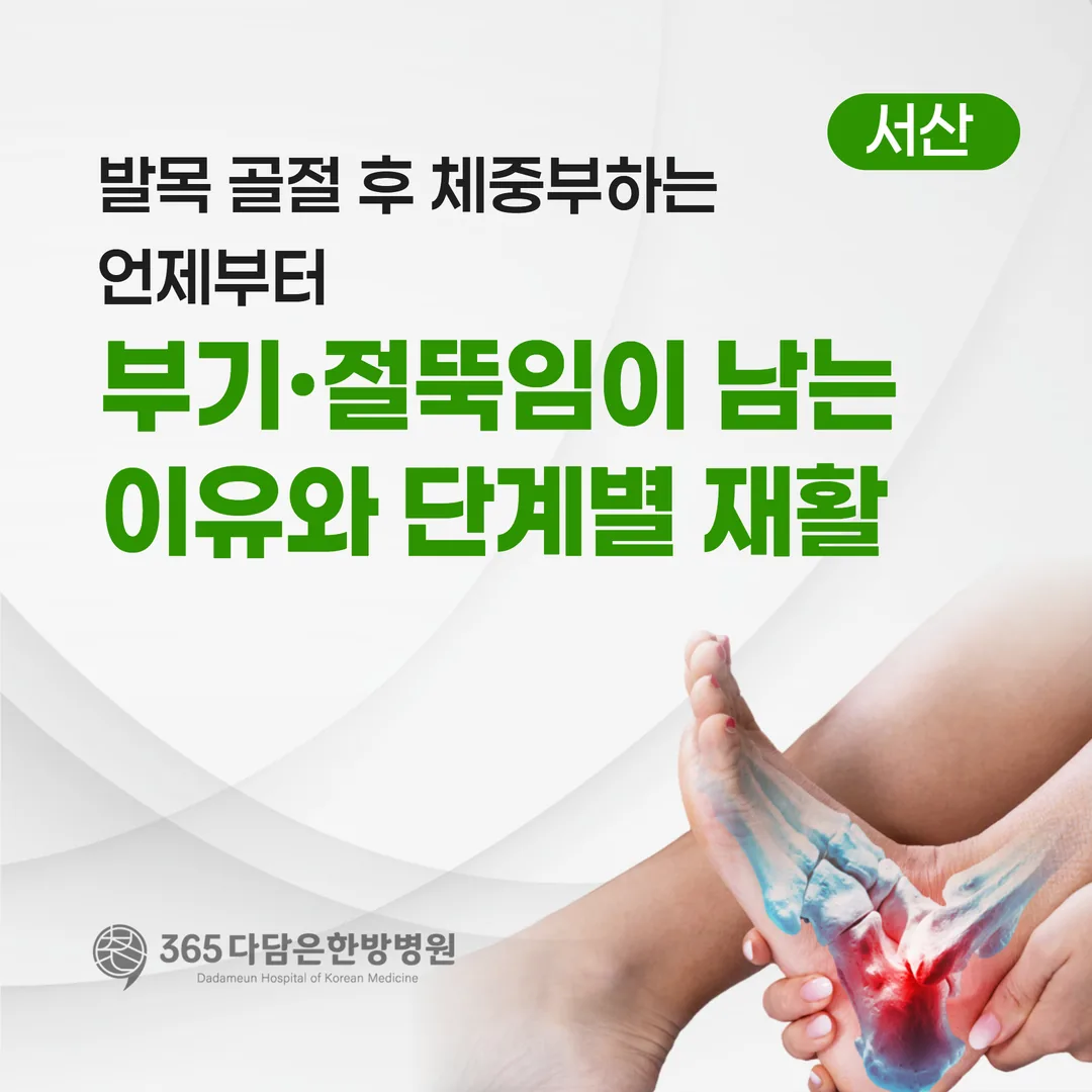 발목 골절 후 체중부하는 언제부터 — 부기·절뚝임이 남는 이유와 단계별 재활