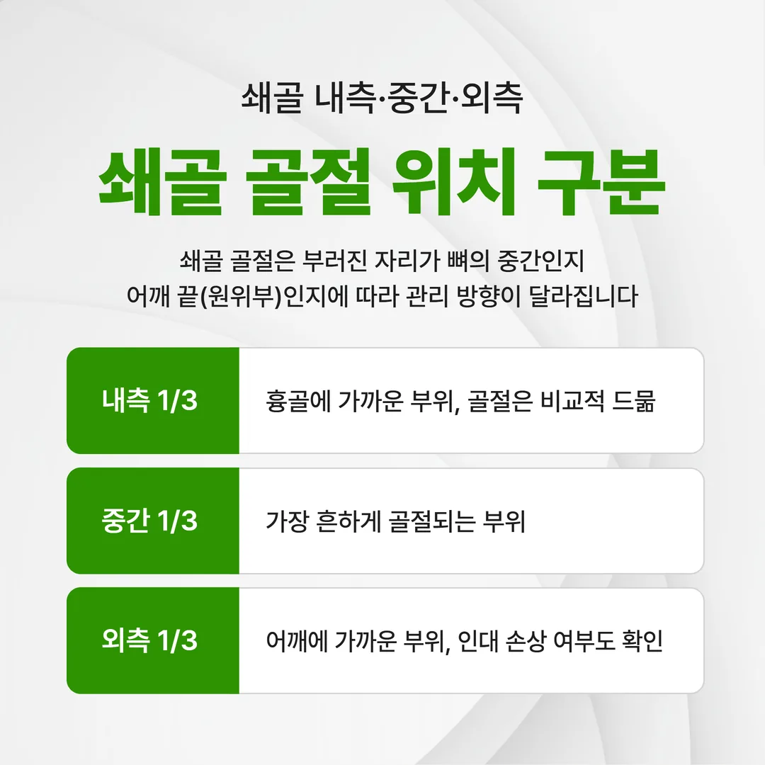 쇄골 골절 위치별 구분 중간부 원위부 도해