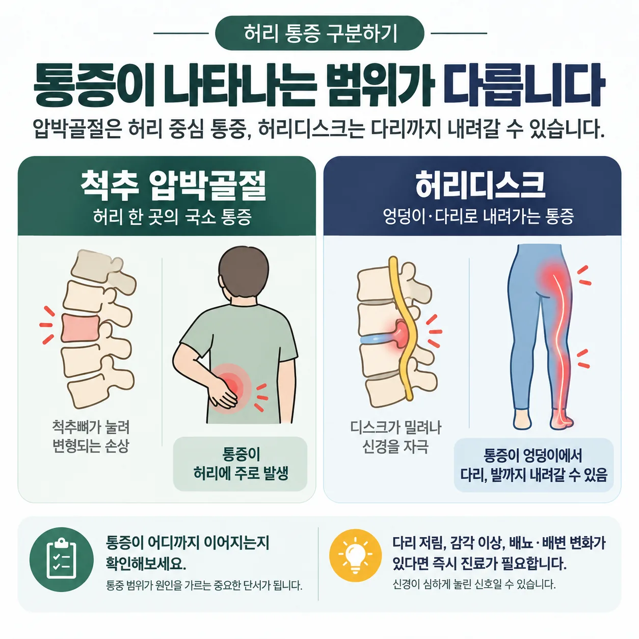 척추 압박골절과 허리디스크의 통증 범위와 다리로 내려가는 경로를 비교한 개념도