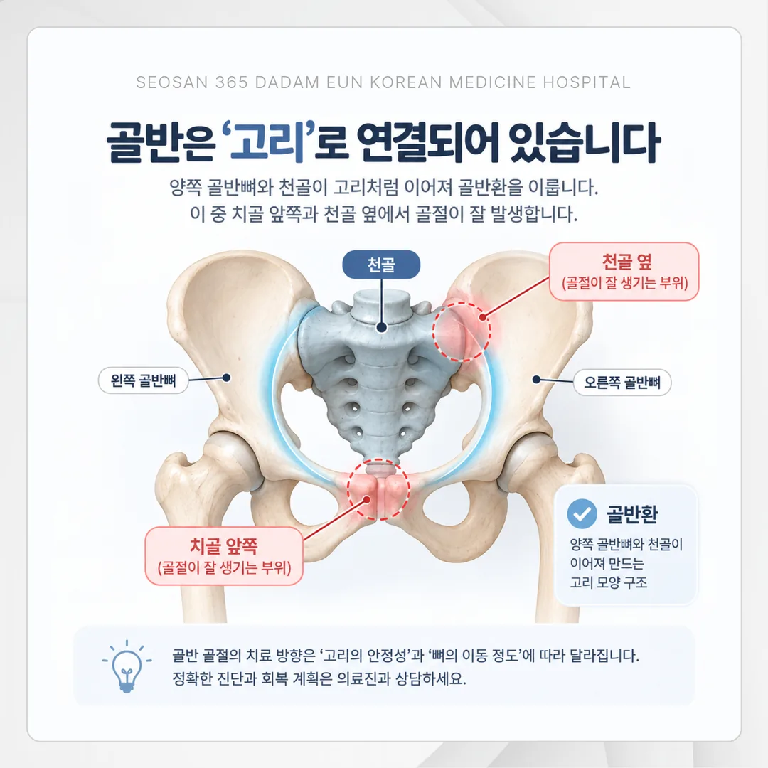 침상 안정 기간에 매일 확인할 세 가지 항목 도식
