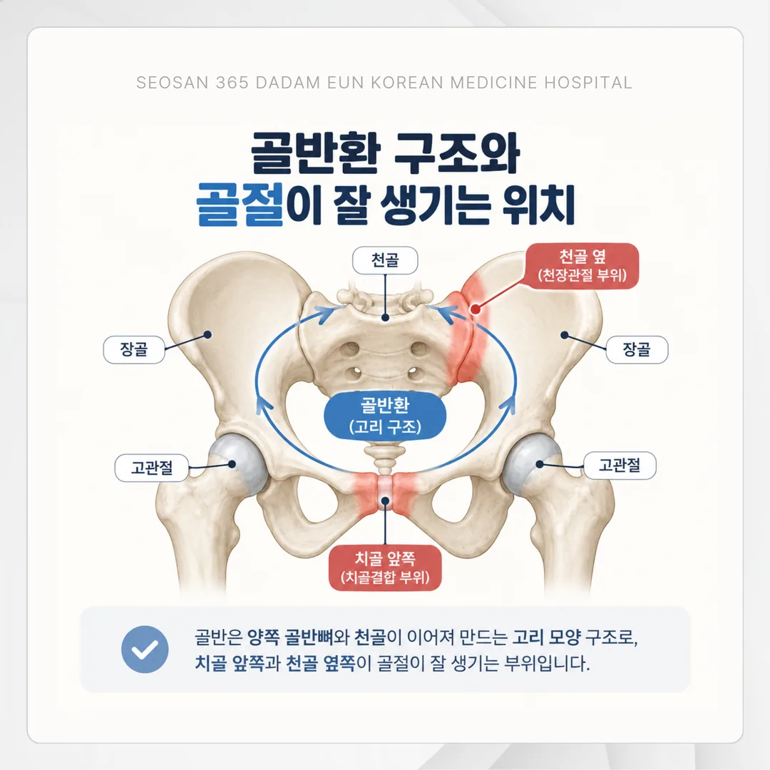 골반 골절 보존치료의 활동 재개 순서를 단계별로 보여 주는 흐름도