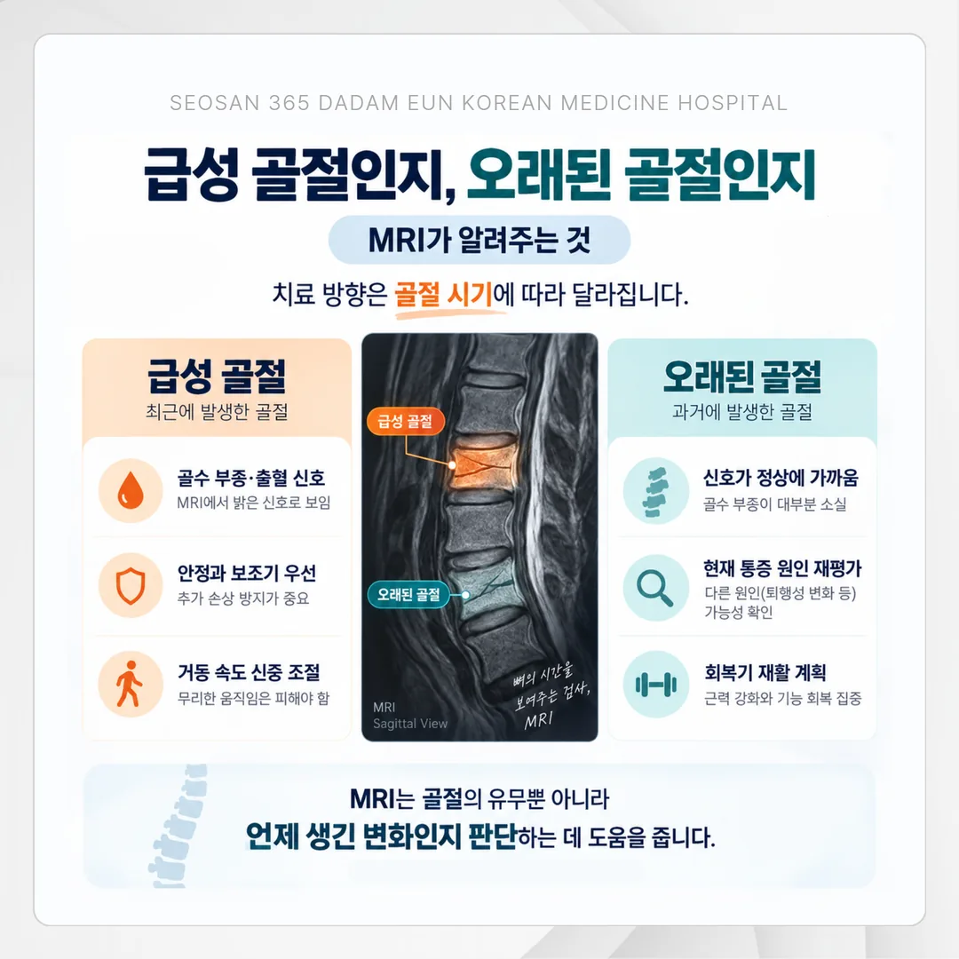 골수 부종 유무로 급성 골절과 오래된 골절을 가르고 치료 판단으로 이어지는 갈림 도표