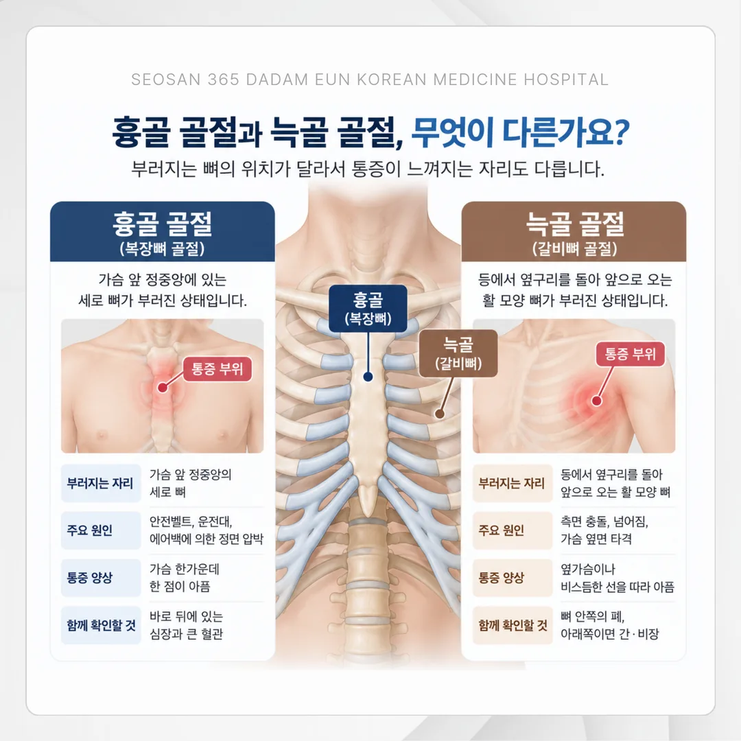 복장뼈(흉골)와 갈비뼈(늑골)의 위치와 통증 부위를 구분해 보여 주는 개념도