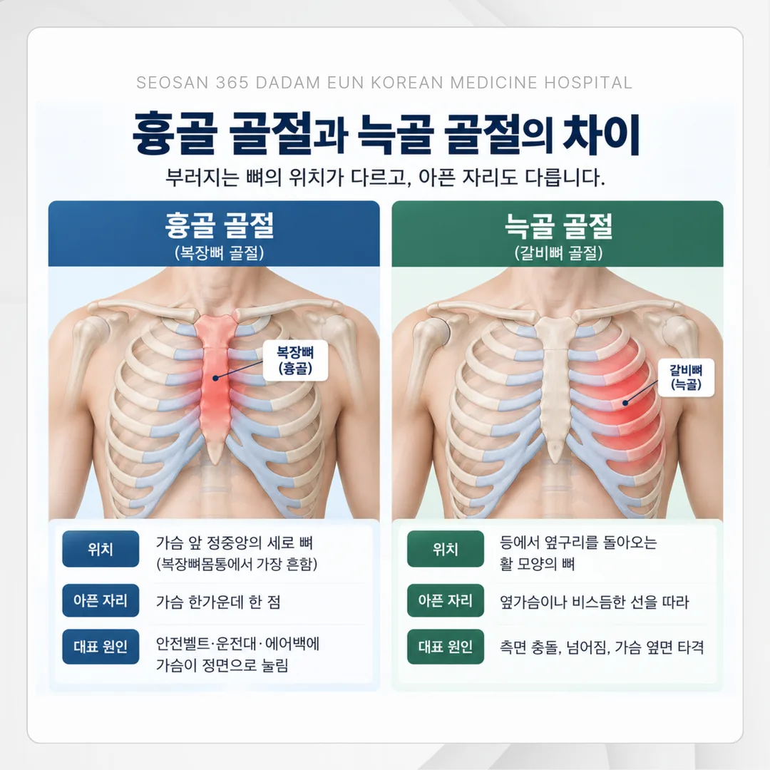 교통사고 이후 가슴 통증이 시간에 따라 변해 가는 경과를 나타낸 그래프