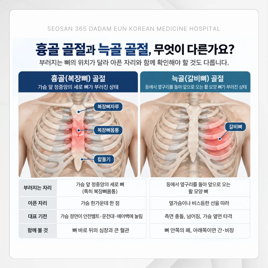 흉골 골절 회복기 관리가 급성기에서 일상 복귀기까지 단계별로 옮겨 가는 흐름도