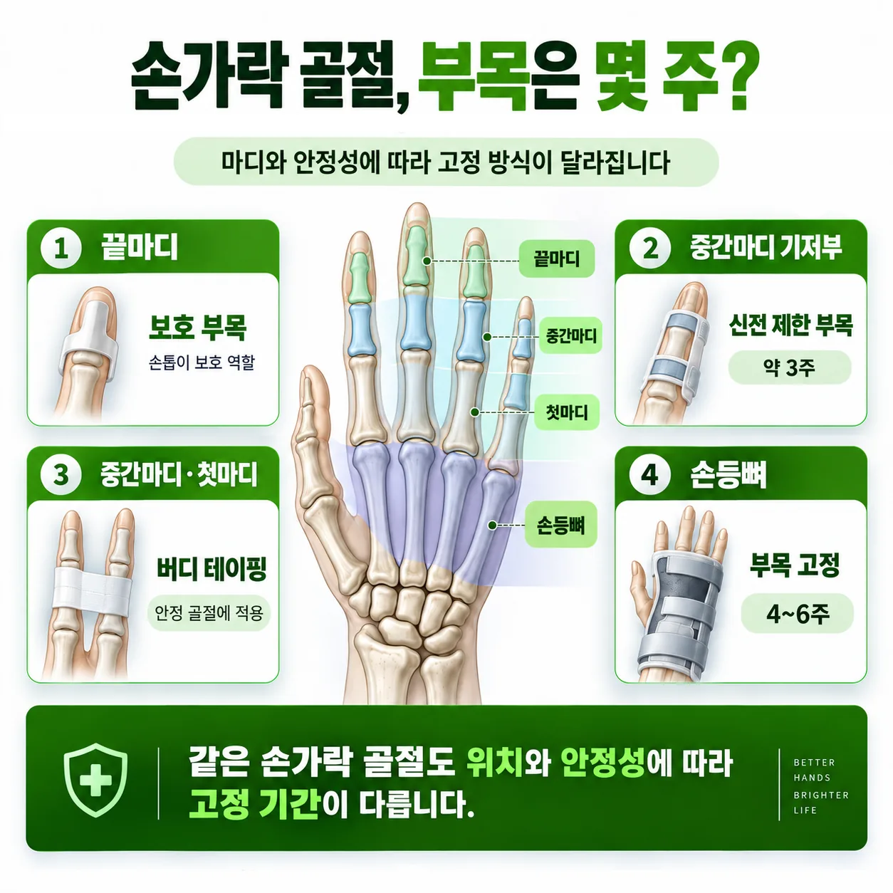 손가락 마디별 골절 위치와 대표 고정 방식·기간을 정리한 개념도