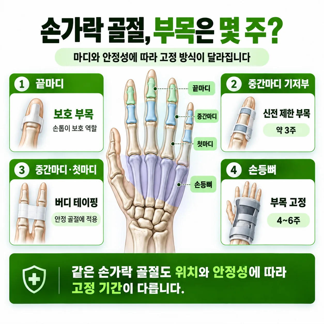 손가락 골절 후 붓기에서 관절 강직으로 진행하는 단계 도식