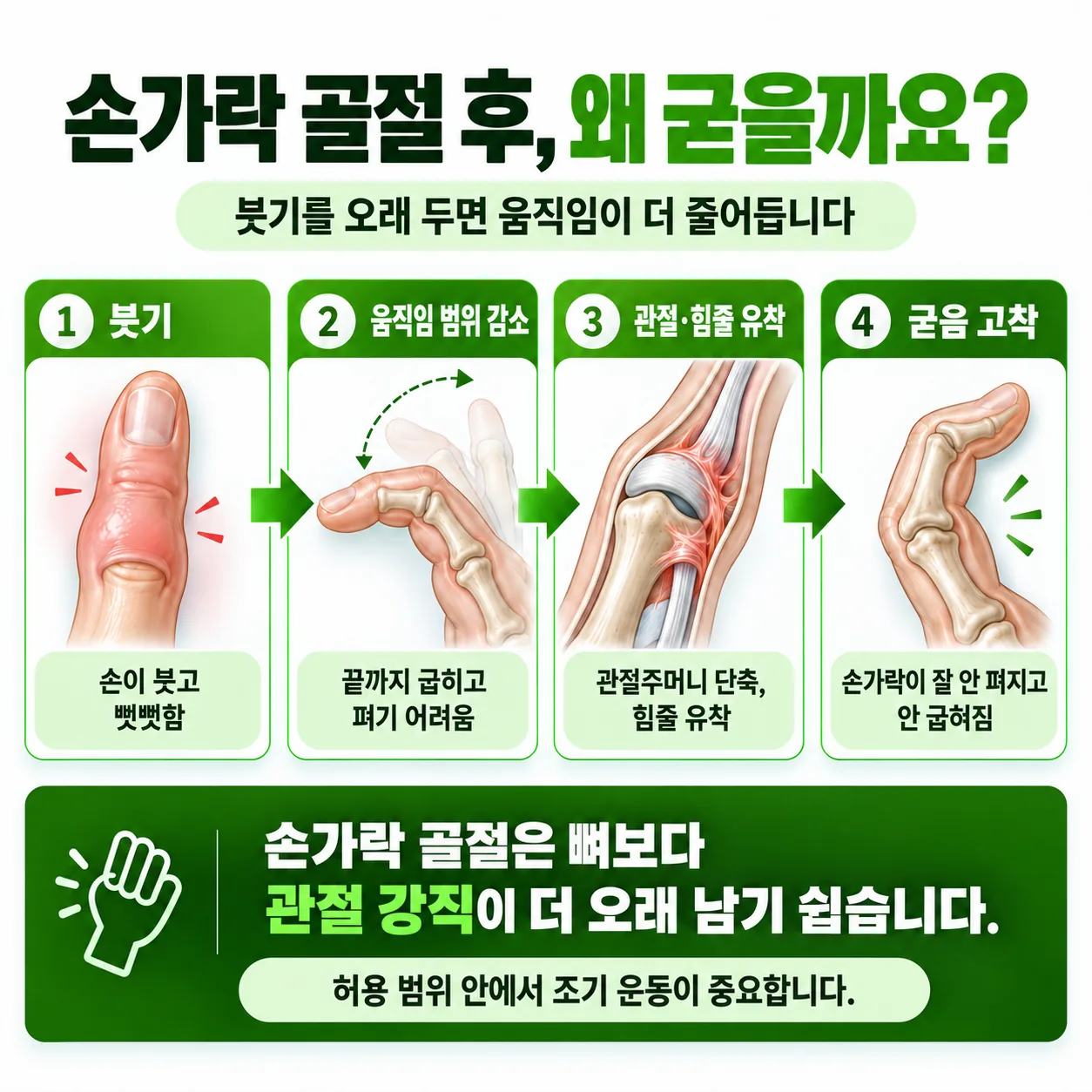 손가락 골절 회복기 재활의 네 단계와 단계별 확인 항목 관계도