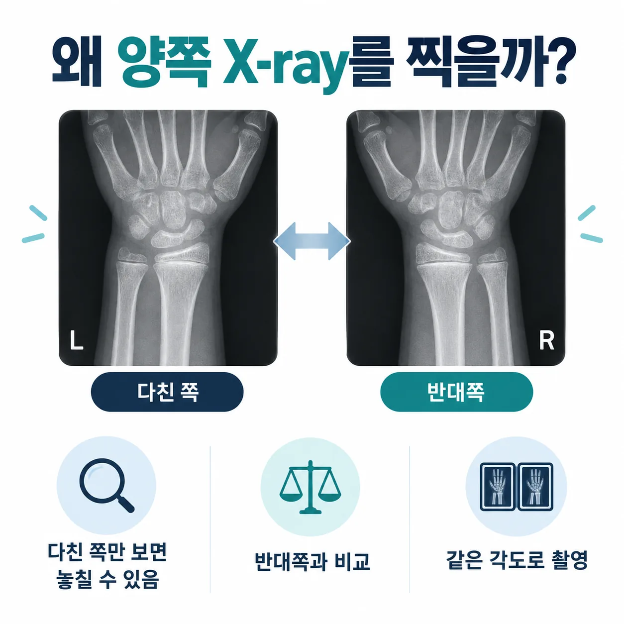다친 쪽과 반대쪽을 함께 촬영해 비교하는 소아 엑스레이 검사 개념도