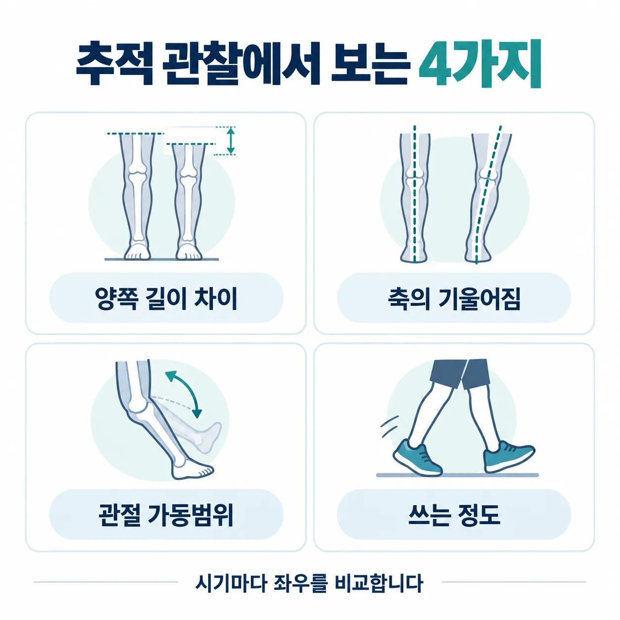 성장판 골절 이후 추적 관찰에서 시기마다 확인하는 네 가지 항목을 정리한 표
