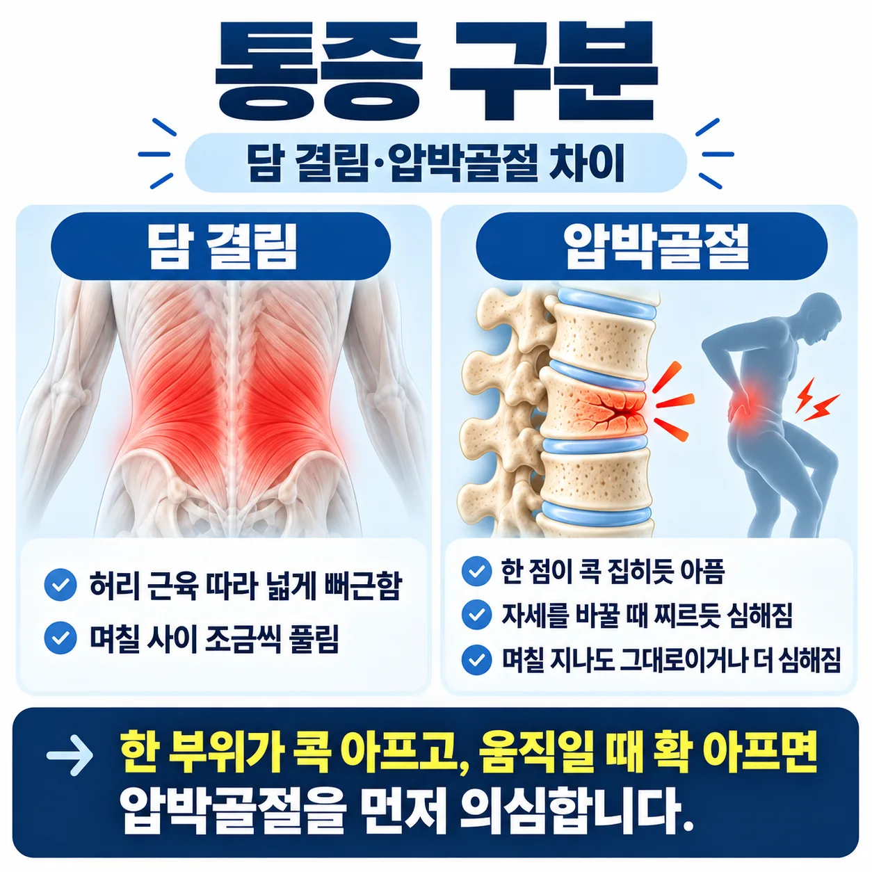 재채기 뒤 담 결림과 압박골절을 아픈 범위와 자세 변화, 며칠 뒤 경과로 비교한 그림