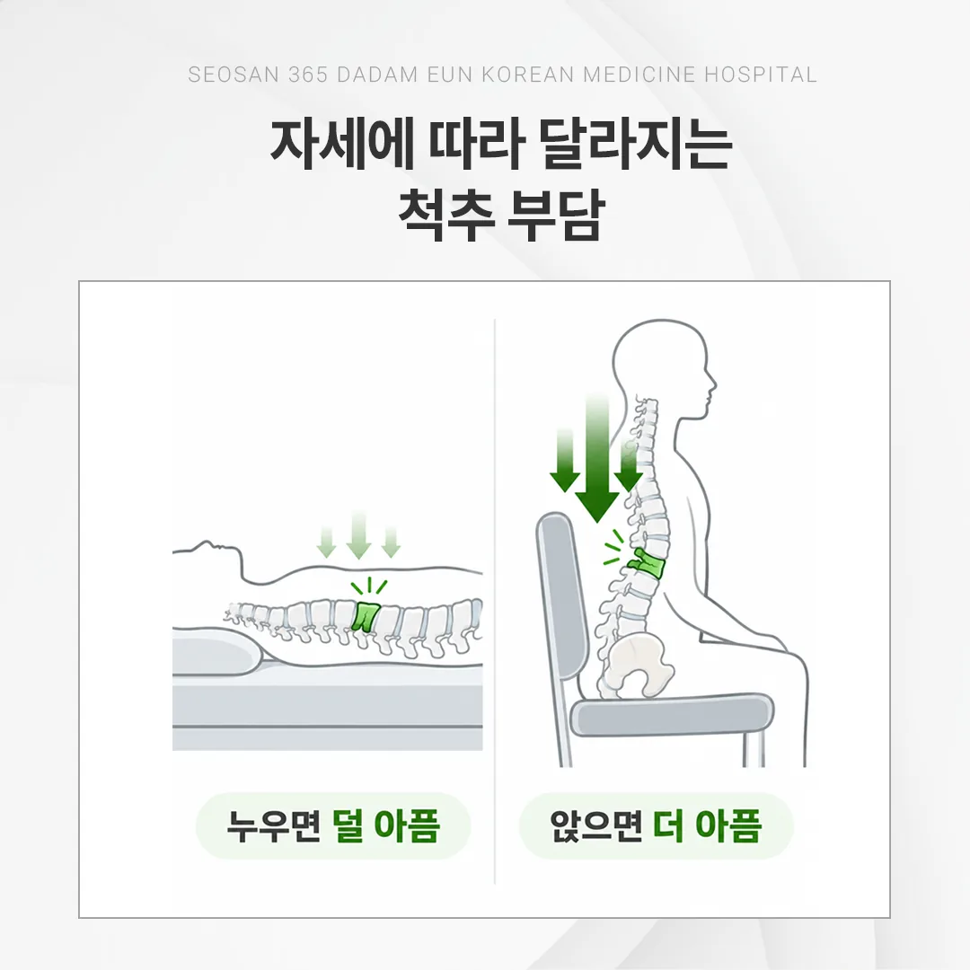 누운 자세와 앉은 자세에서 압박골절 부위에 실리는 무게를 비교한 척추 개념도