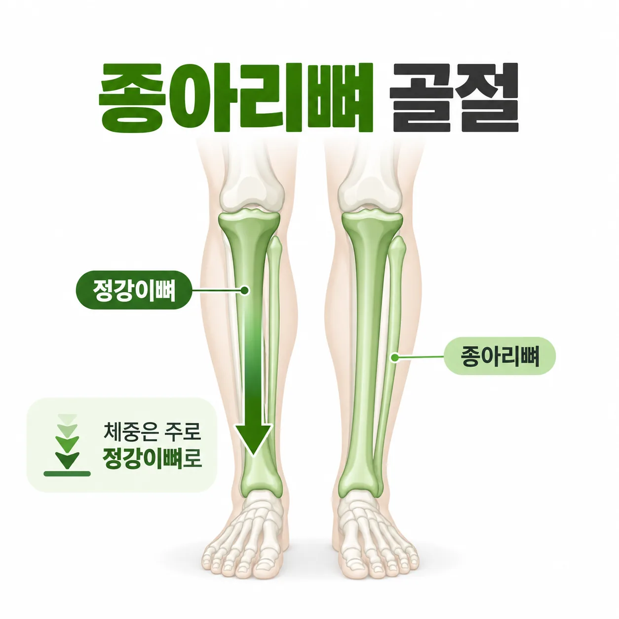 안쪽의 굵은 정강이뼈와 바깥쪽의 가는 종아리뼈 위치, 몸무게가 실리는 방향 개념도