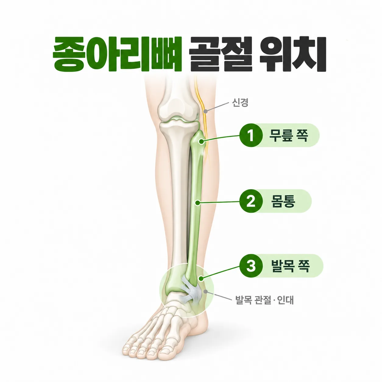 종아리뼈 몸통 골절과 발목 쪽 골절에서 체중을 싣는 속도를 비교한 개념 그래프