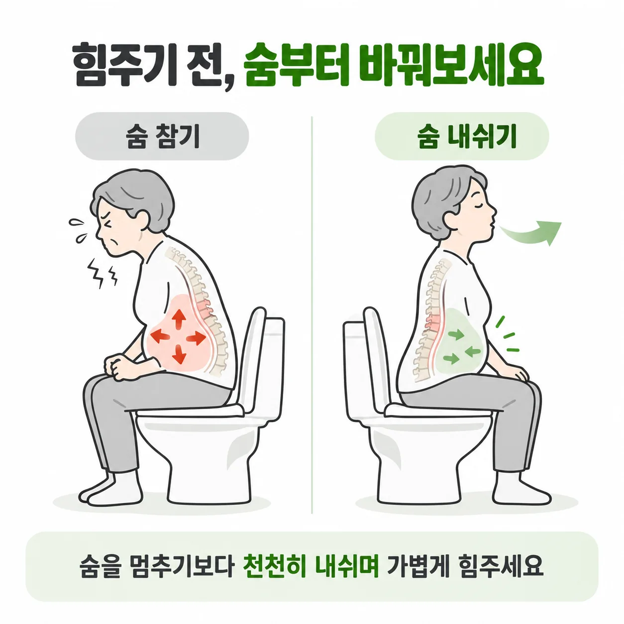압박골절 변비 때 숨을 참고 힘주기와 숨을 내쉬며 힘주기를 비교한 몸통 옆모습 도식