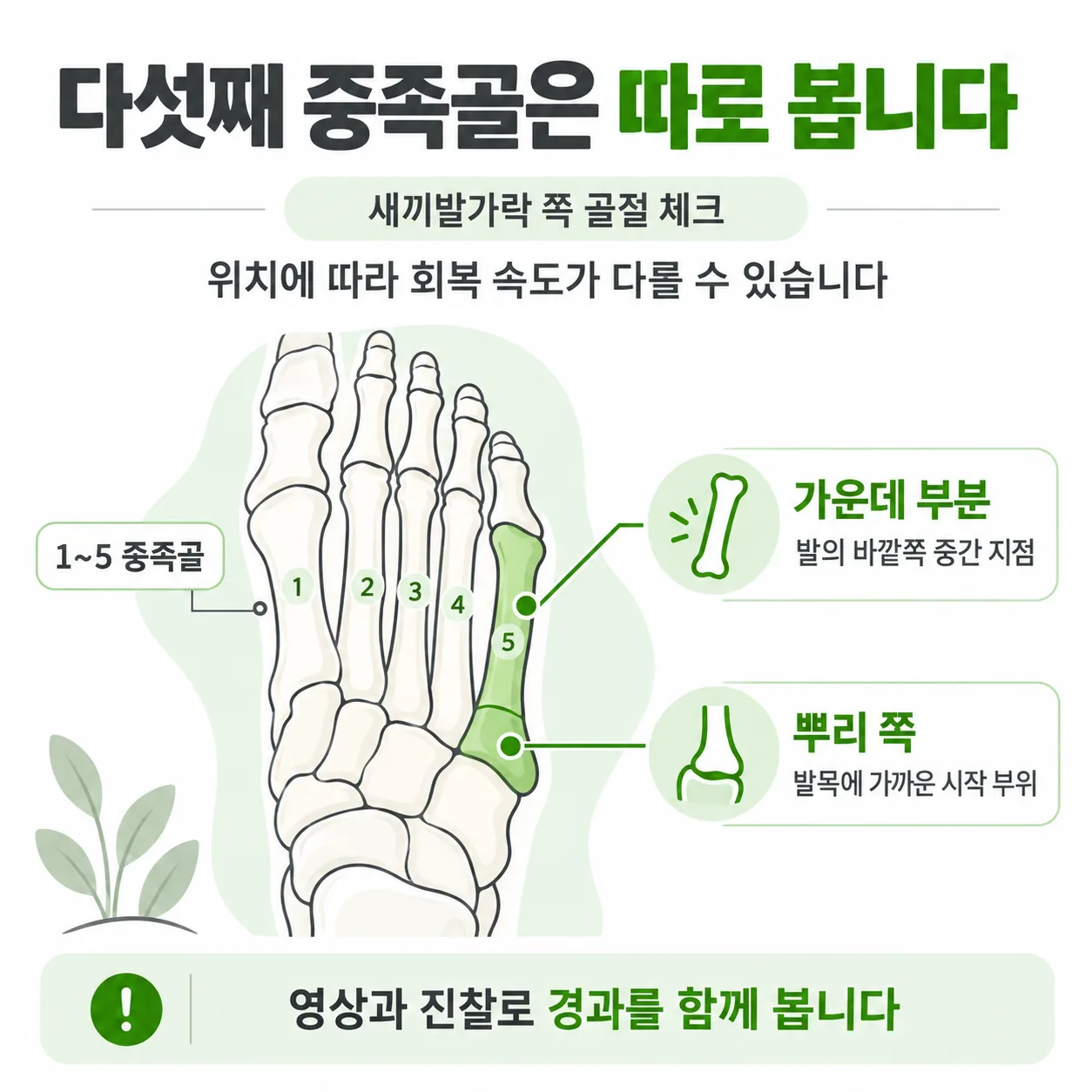 중족골 골절 뒤 걷는 시간을 집 안부터 바깥까지 한 단계씩 늘리고 다음 날 아침 붓기를 보는 순서 도식