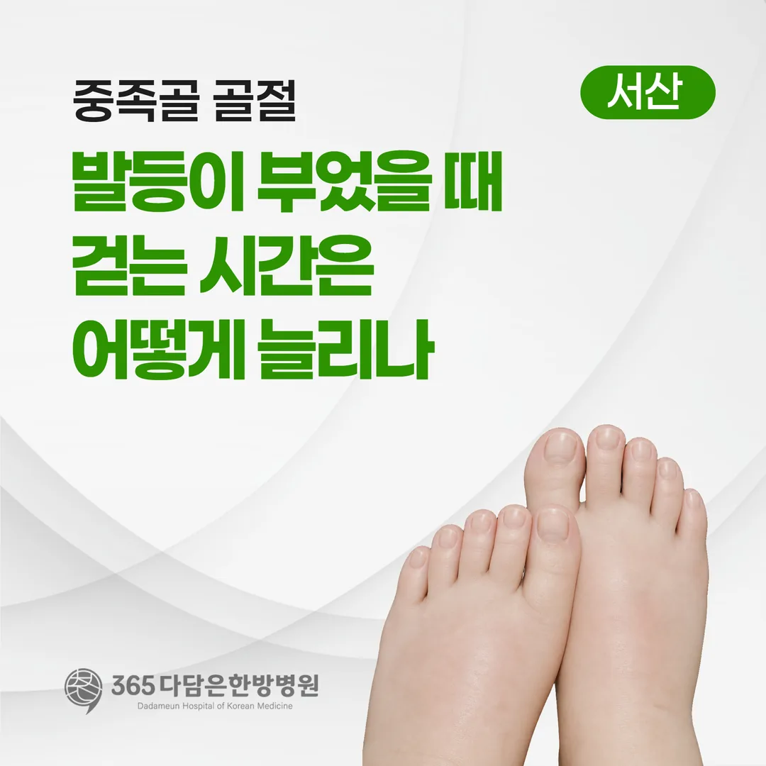 중족골 골절, 발등이 부었을 때 걷는 시간은 어떻게 늘리나